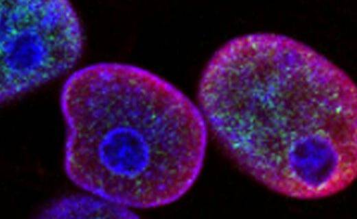 kokhucre-520x600 (1)